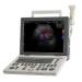 SonoAce R3