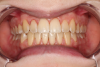 Magic Smile: описание и особенности процедуры
